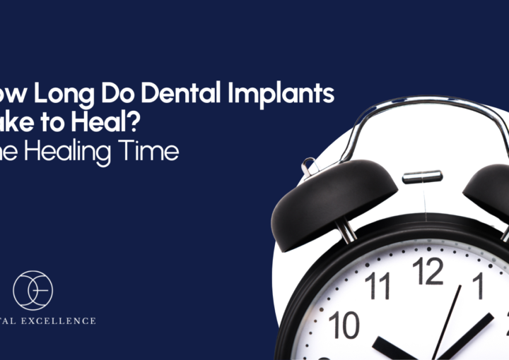 How long do dental implants take to heal?