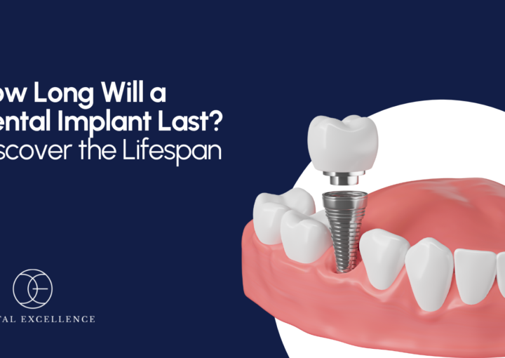 Do dental implants hurt? Understanding the pain involved