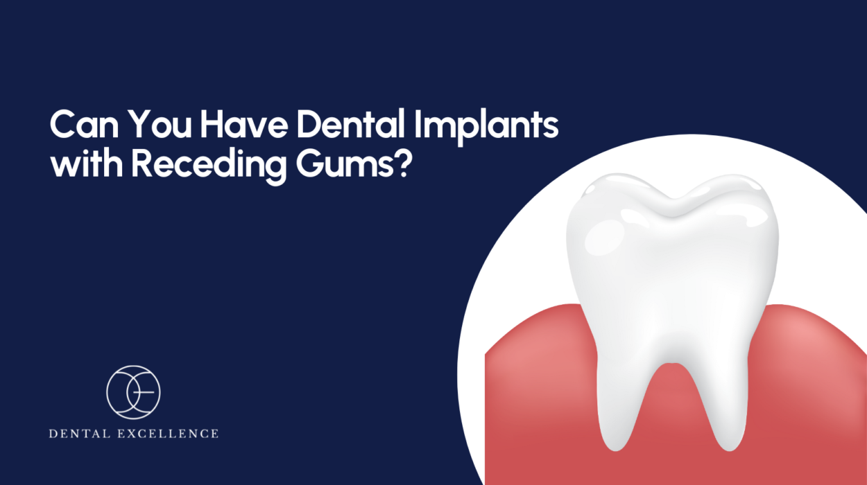 Can you have dental implants with receding gums?