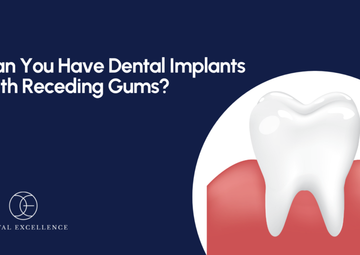 Can you have dental implants with receding gums?