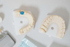 How long dental implants last?