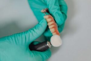 How long do dental implants will last? Maintenance