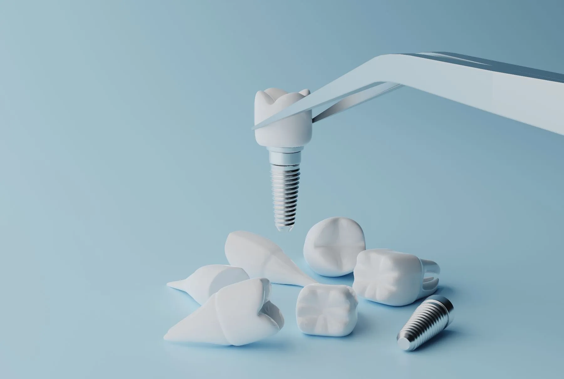 Dental Implantology Glossary