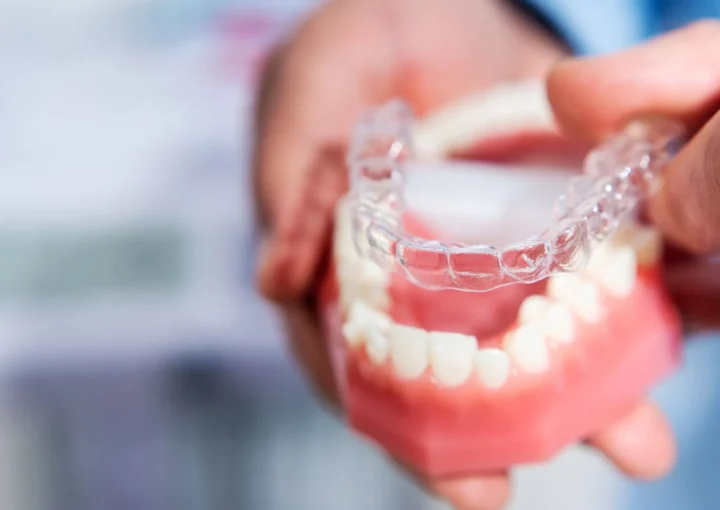 Orthodontics Glossary