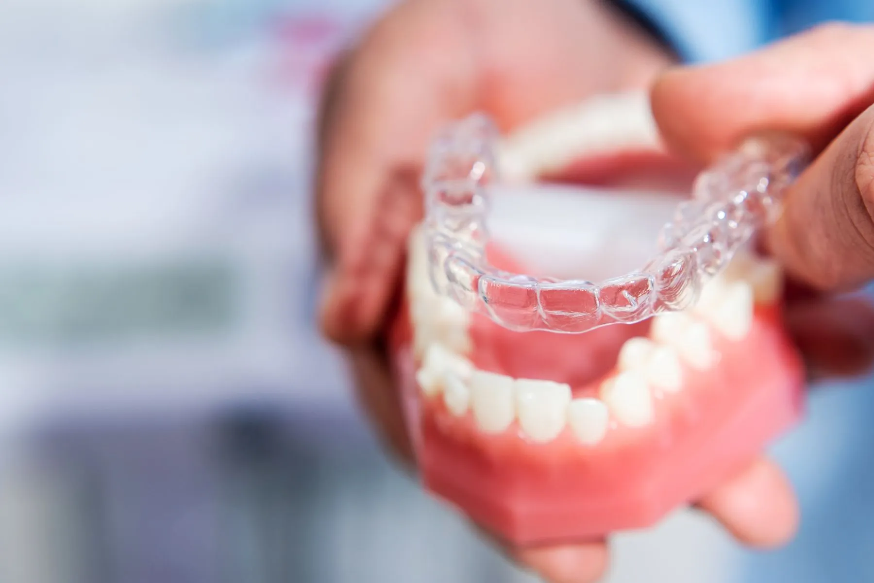 Orthodontics Glossary