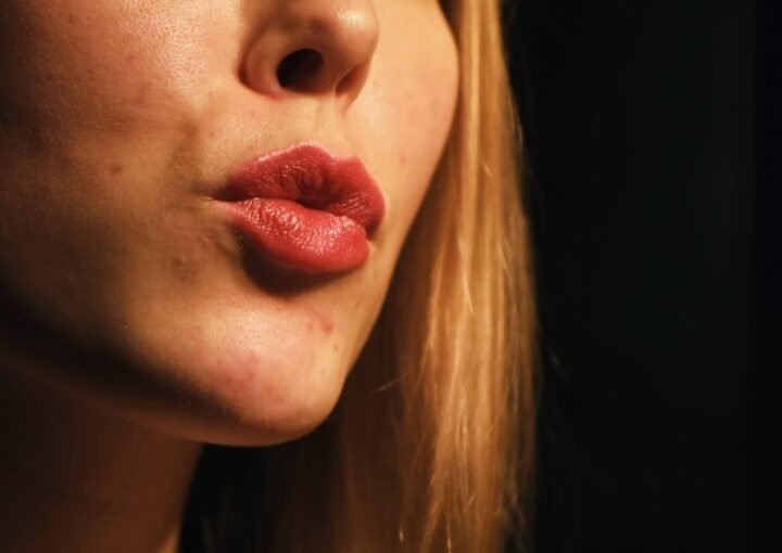 Aesthetic Treatments Glossary